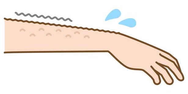 鳥肌の「鳥」はガチョウだった!? 「顔には鳥肌が立たない」は本当か検証/毎日雑学1