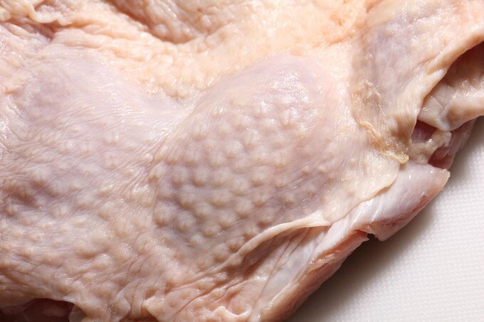 鳥肌の「鳥」はガチョウだった!? 「顔には鳥肌が立たない」は本当か検証/毎日雑学